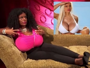 Έχει χαθεί η λογική: Κάνει ενέσεις για να μεγαλώσει το στήθος της και να γίνει... μαύρη (βίντεο)